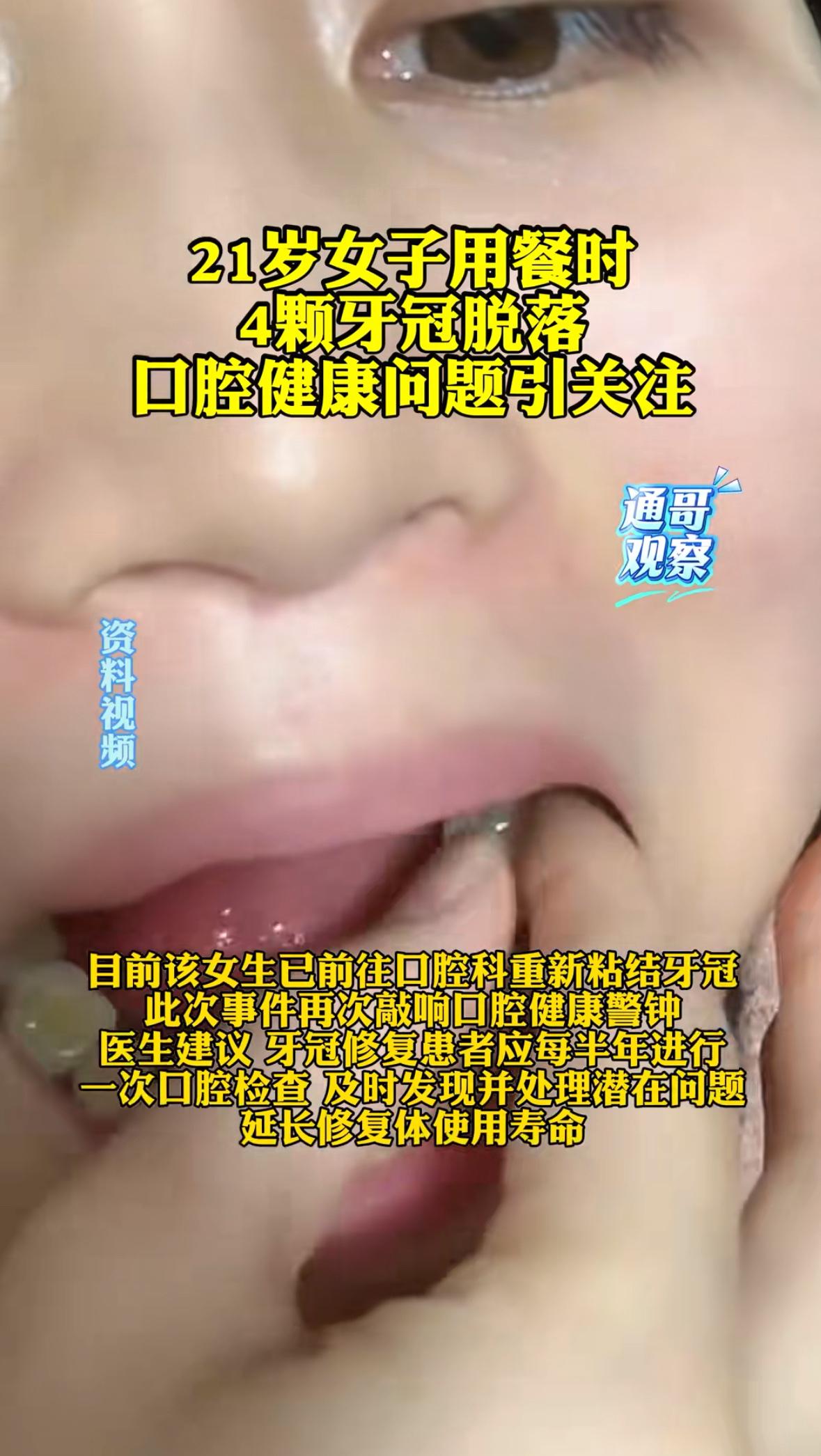 “天塌了！”9月28日，福建一位21岁女生在社交平台发布视频，举着四颗连根脱落的