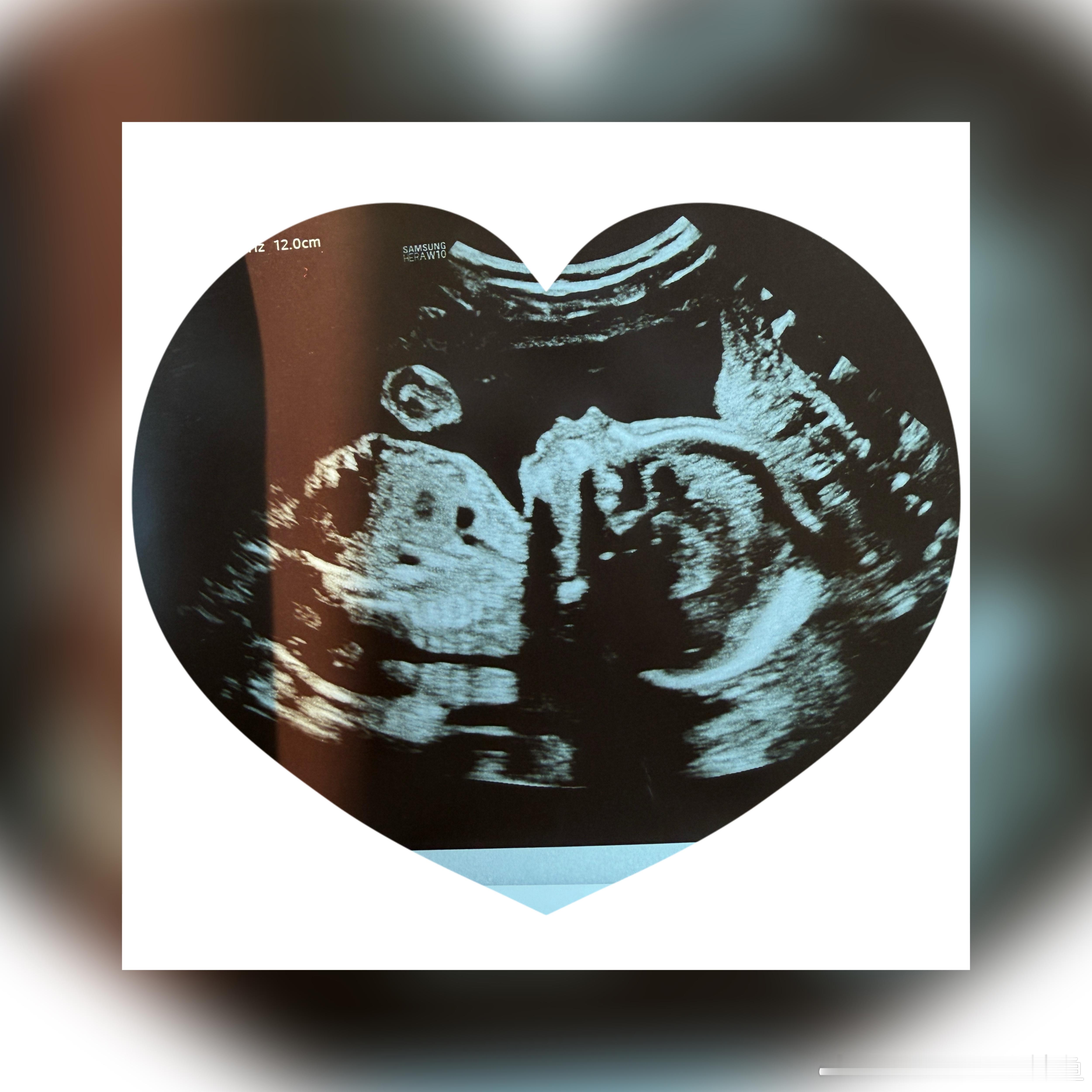 应该有些姐妹已经猜到啦，没错[可爱]我们一家三口，马上要变一家四口～崽崽要当哥哥