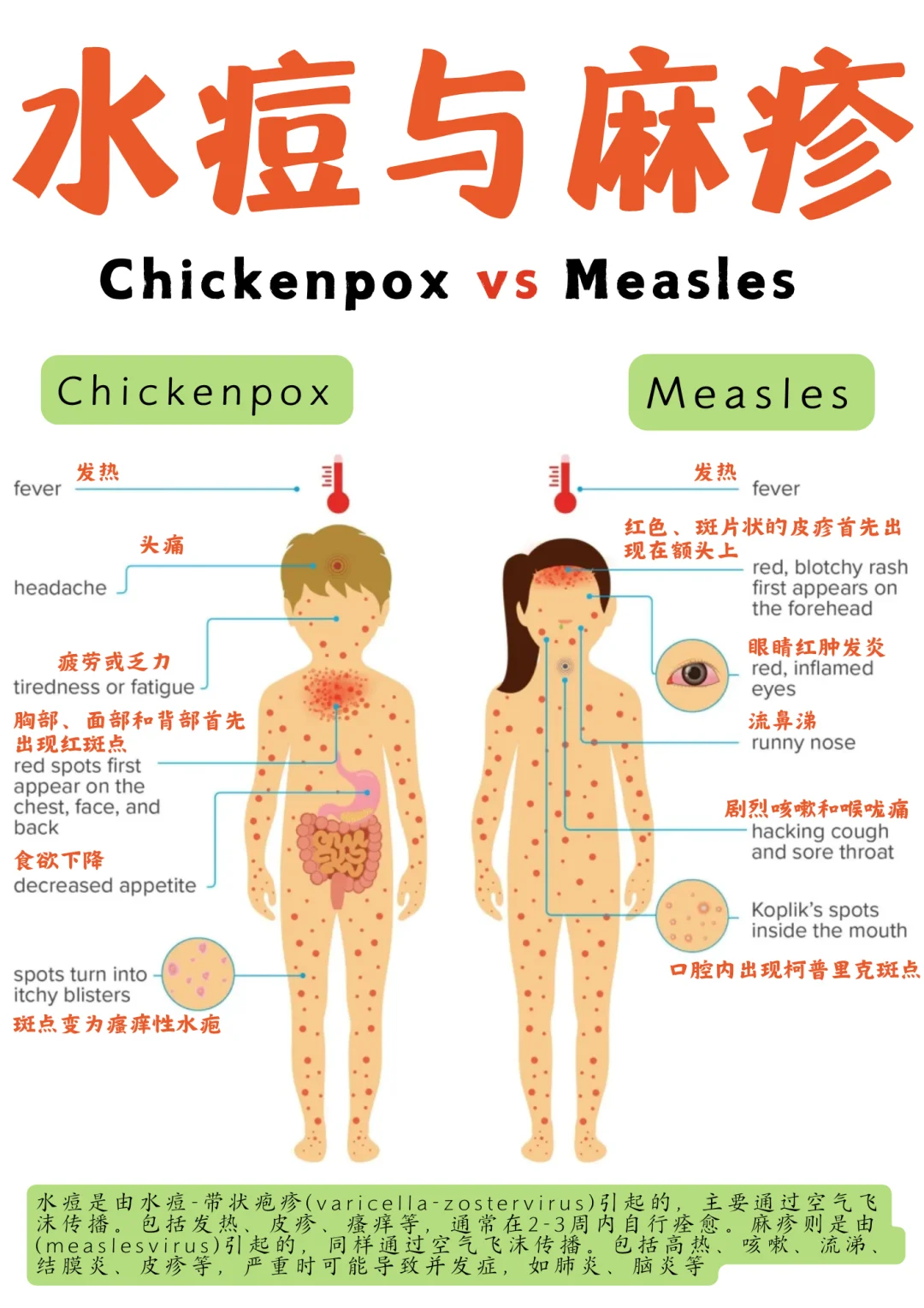 备考RN/水痘和麻疹！！学！！单词