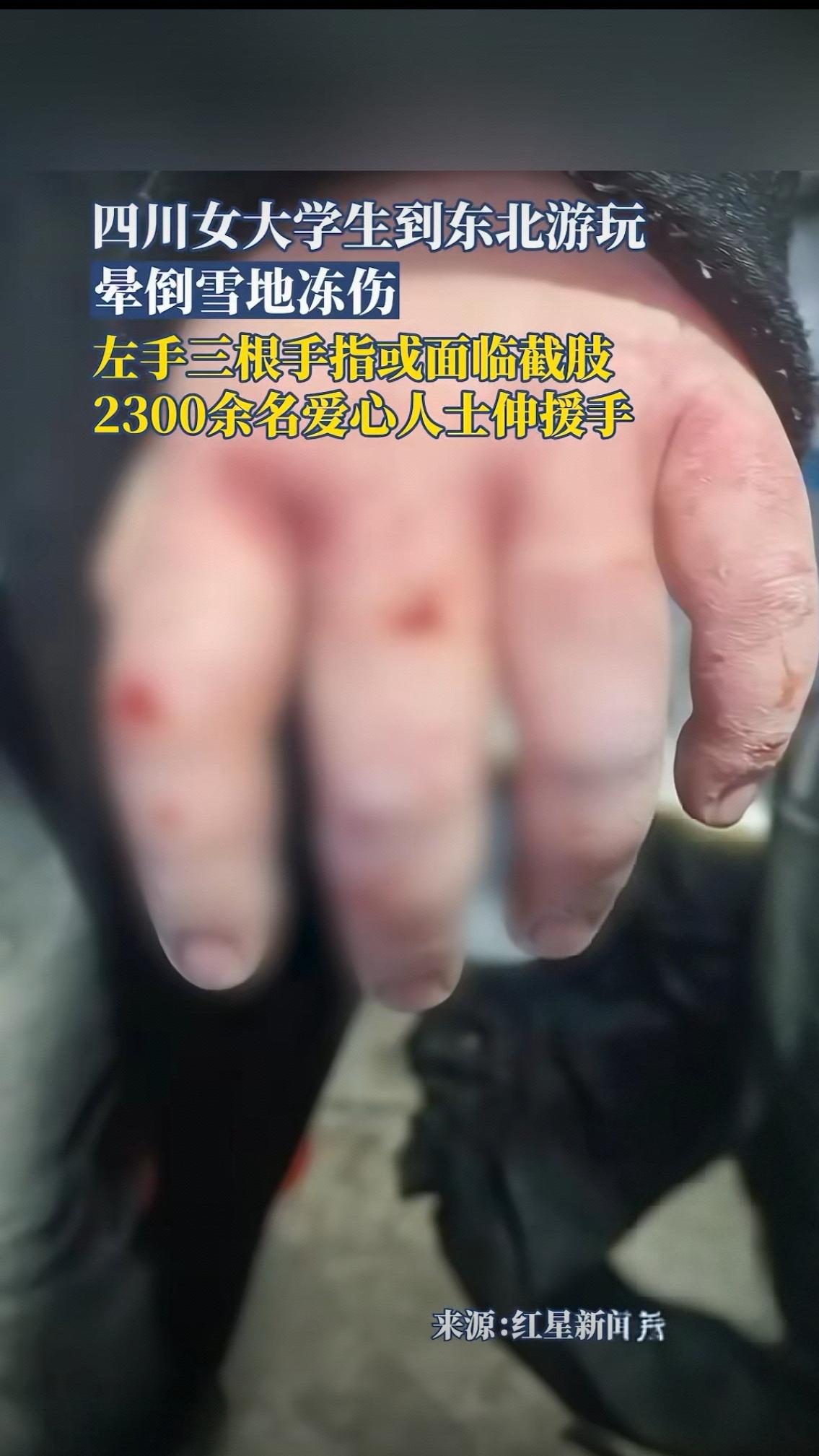 21岁的小陈怎么也想不到，一场攒了许久的东北之旅，会让她在病房里对着发黑的手指默