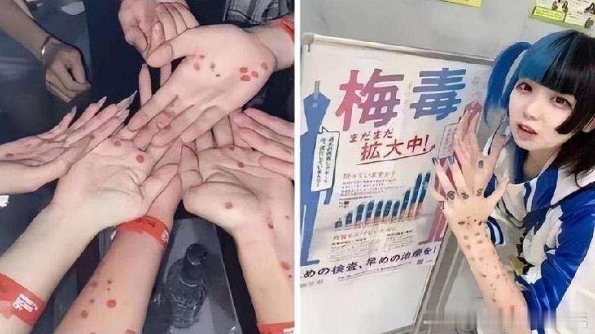 日本流行梅毒妆日本梅毒扩散日本梅毒又上热搜了。这次是年轻人聚众晒梅毒红斑、化“梅