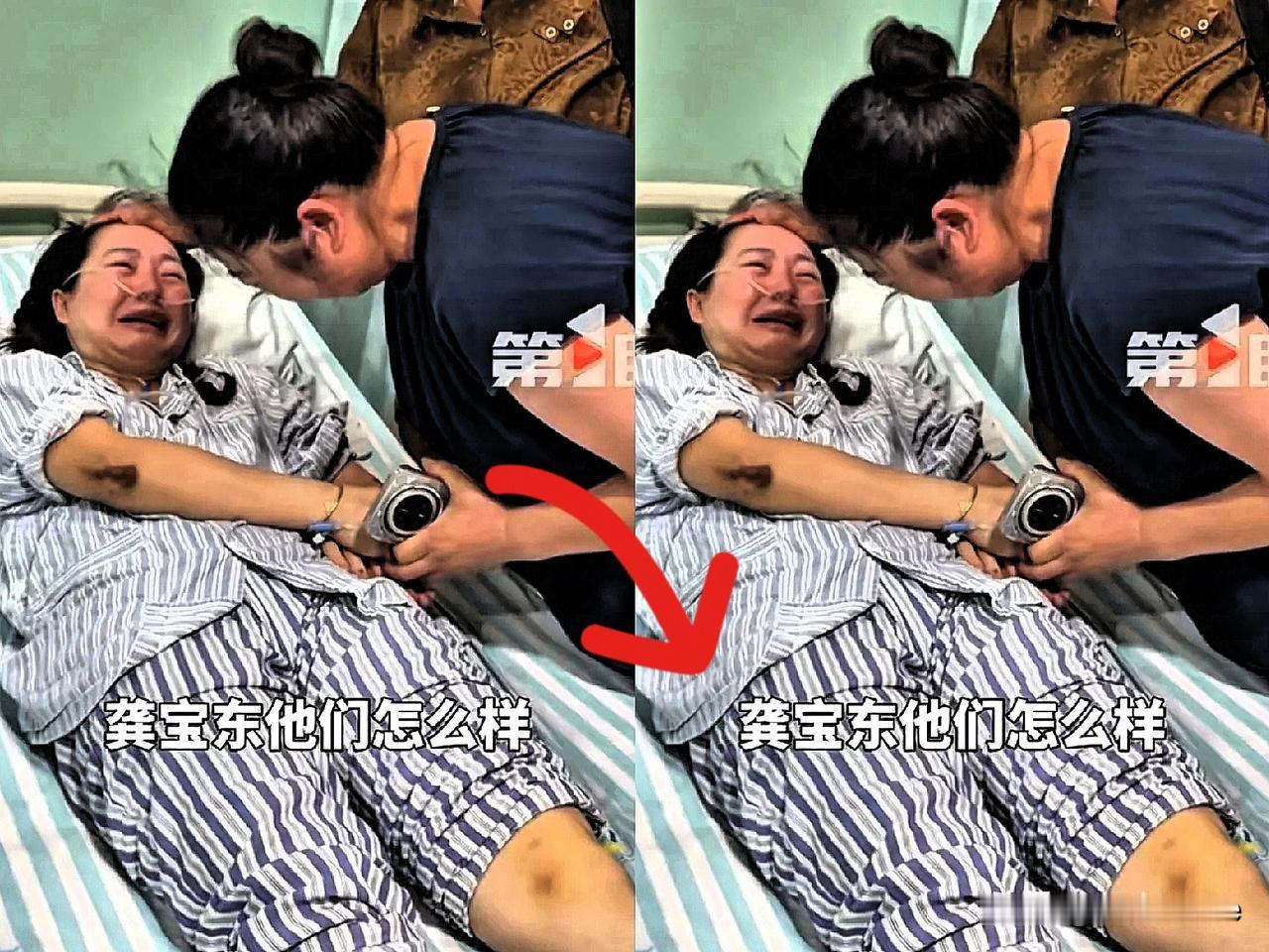 彭迪哭着询问龚宝东等人的情况。受伤躺在病床上的他，见到领导、社区女书记张维玲到来