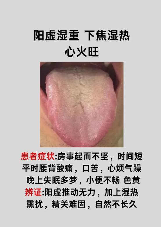 看舌知肾：4 种舌象，一眼分清肝肾亏虚、肝郁化火等问题