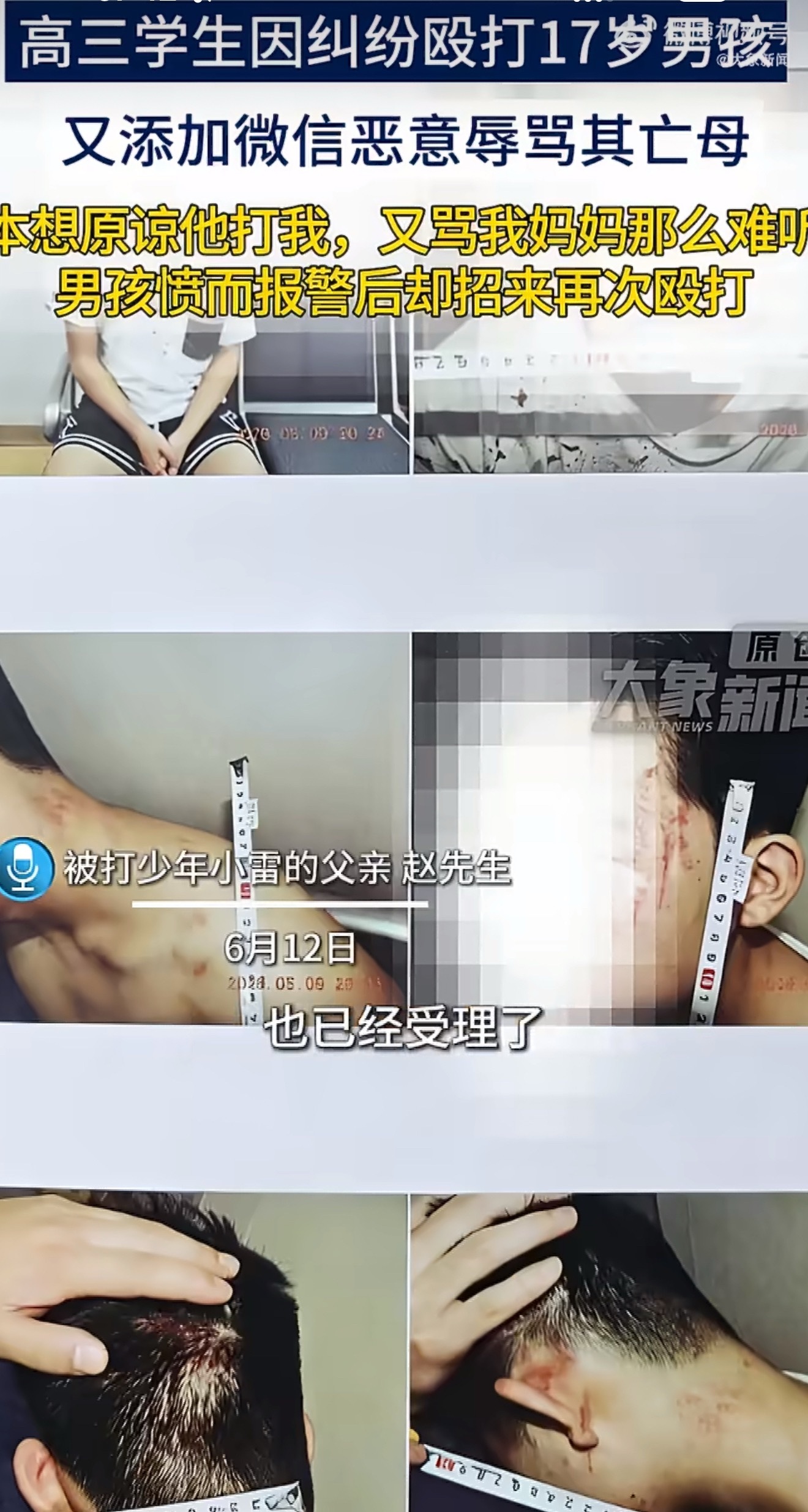 17岁男孩想原谅施暴者却被辱骂亡母打我我可以原谅，但骂我妈妈不行，必须报警！这是