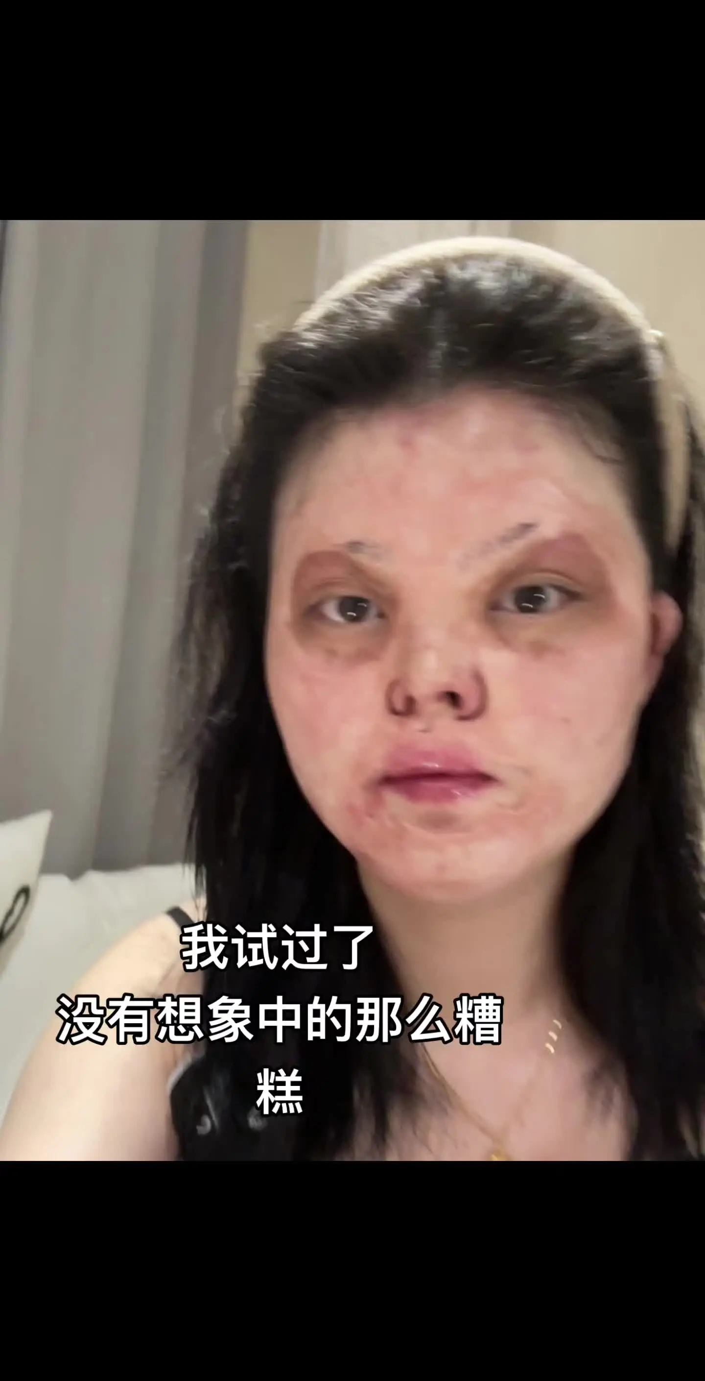 勇敢的走出去 去感受阳光