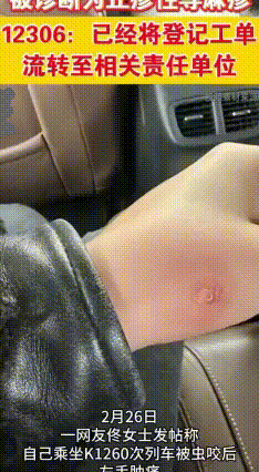 你信吗？出门坐火车居然还能被虫咬
黑龙江的佟小姐姐坐K1260次列车，本想顺顺当