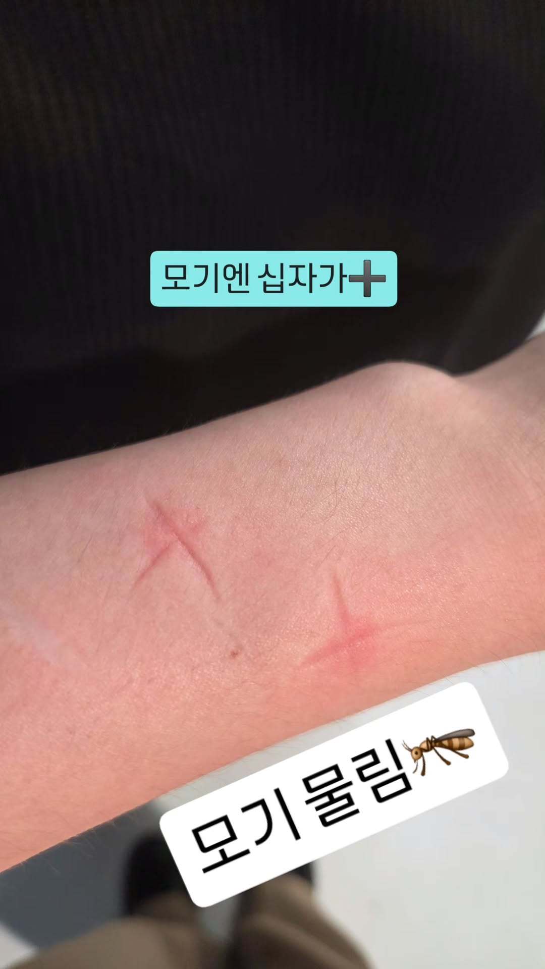 “CB百蓝_。260708金希澈 ins story更新：蚊子包就要掐十字➕被蚊