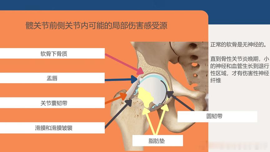 髋关节疼痛  今天来讲髋关节疼痛【与髋关节相关的疼痛】——尖锐疼痛的部位来源于髋