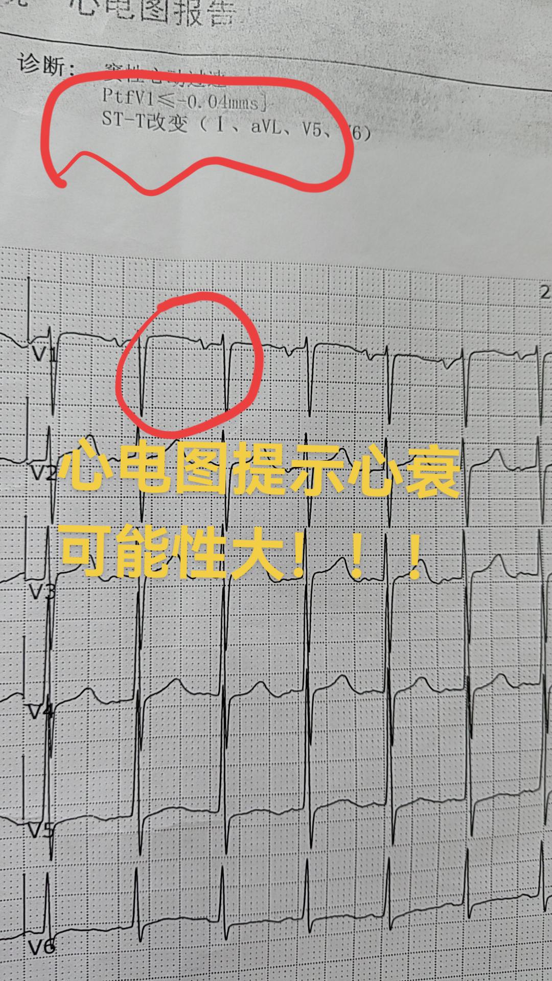 关注我每天坚持分享知识 每天坚持一点点 医学科普 医学影像 医生日常
