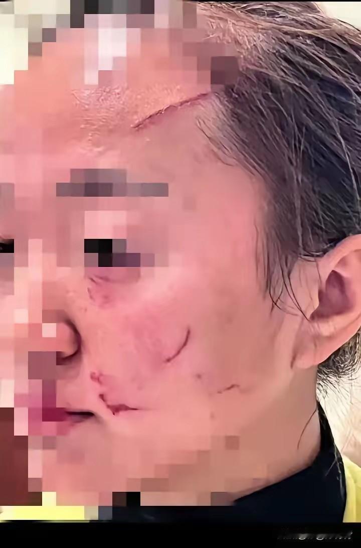 婆婆和儿媳妇打架，婆婆占了上风，儿媳妇的脸被婆婆挠了！往后，这个婆婆还有好果子吃