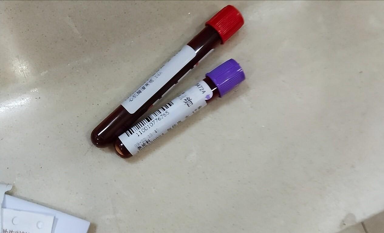 呼吸科医生心里有数。哪些病人能扛住治疗，哪些病人身体先垮，他们看门诊时打眼一瞧就