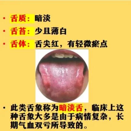 舌头是身体健康的晴雨表，不同的舌象可能预示着不同的身体状况。今天周老师将为我们总