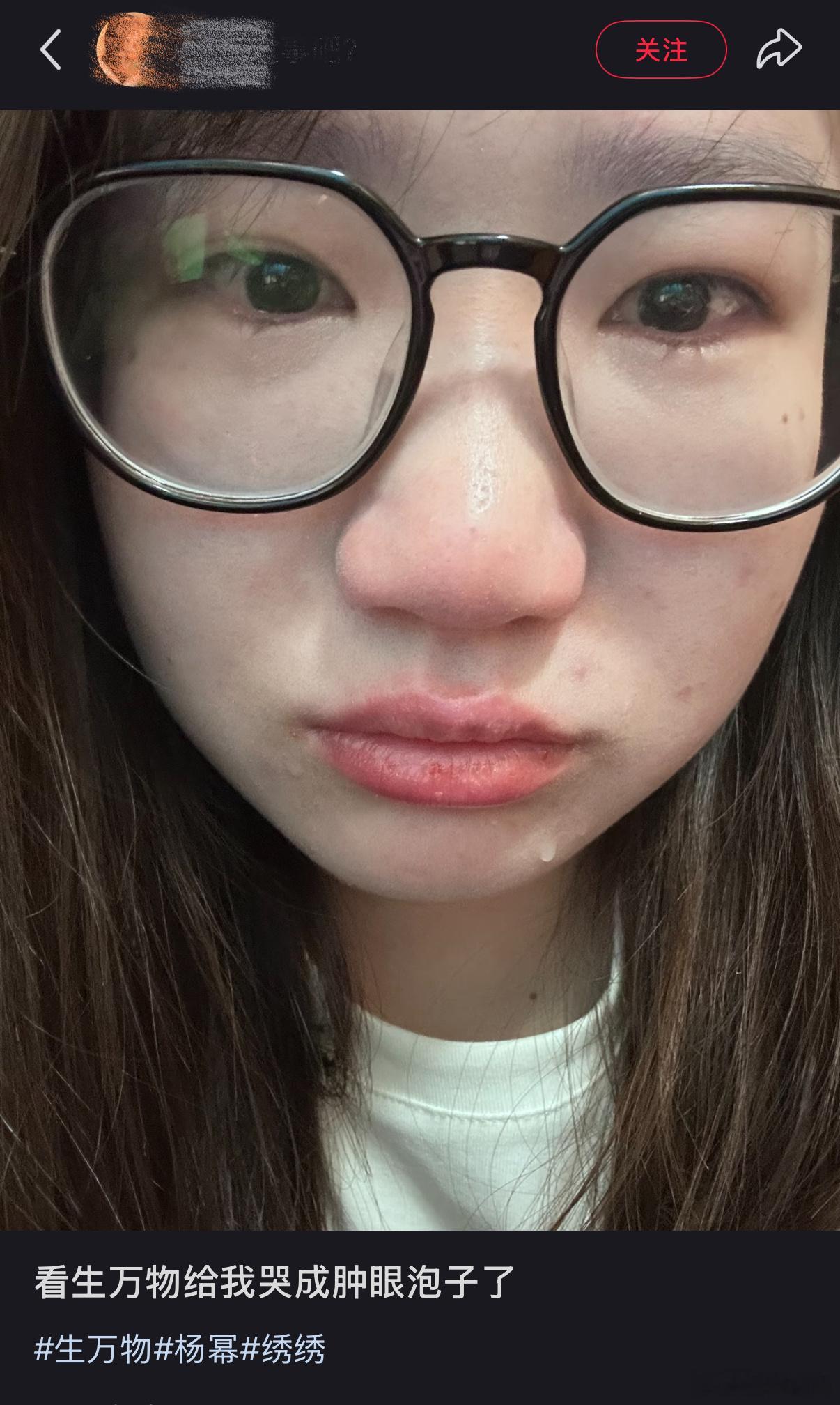看生万物哭成肿眼泡子 眼睛肿得像核桃，苏苏的苦尽甘来成泡影，村里人嚼着猪食反抗，