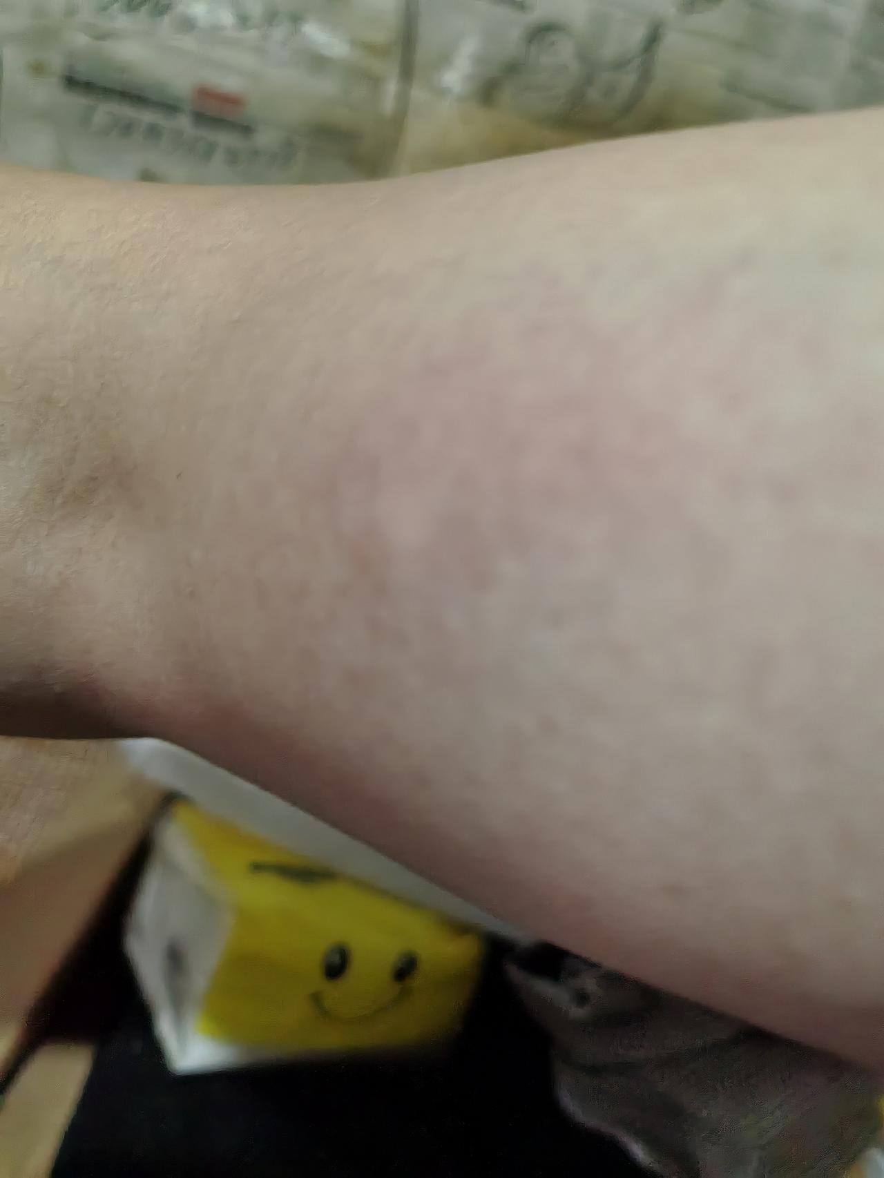 今年蚊子应该比往年要多。往年夏天蚊子都是从晚上七八点开始活跃，但今年不是。今年是