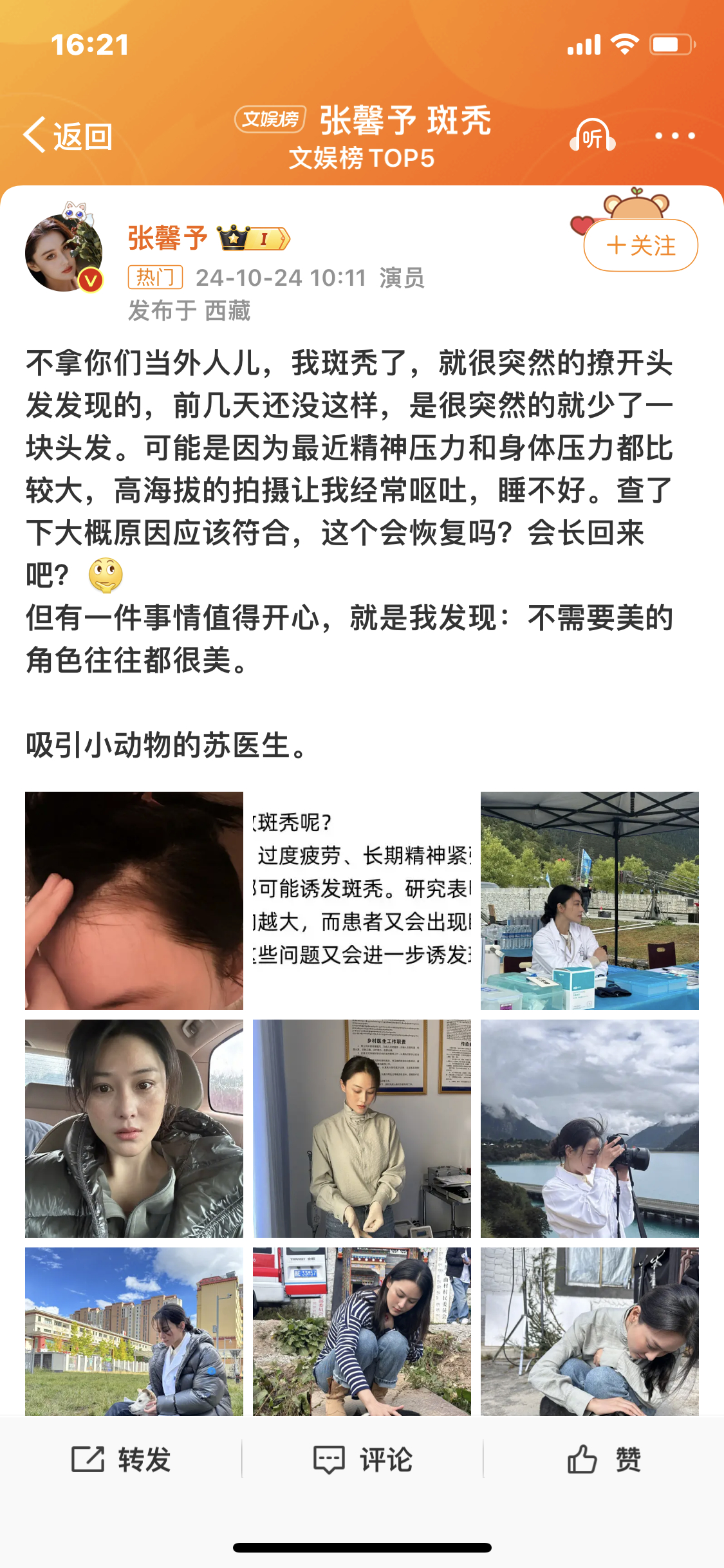 #张馨予 斑秃#看得出来，姐姐是真不把我们当外人呀，好接地气的姐姐[可怜]头发少