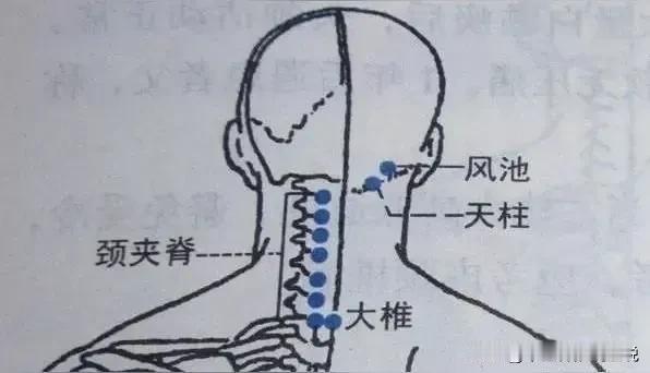 九组针灸法清热，体内所有的热气都可以清除：
1玉女方：针补双复溜，泻双内庭。  