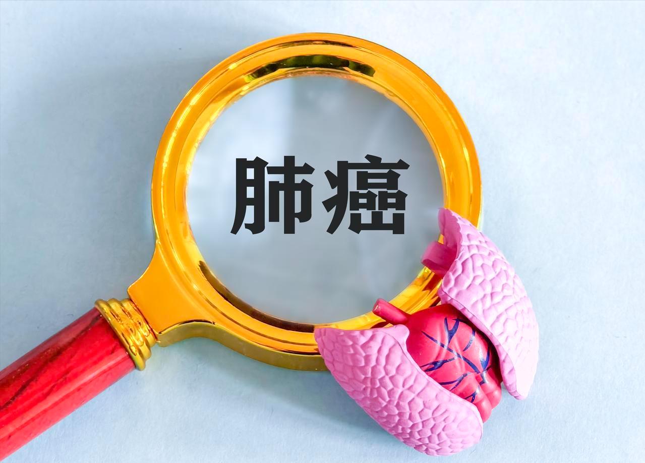 如何早期发现肺癌，有几个容易判断的点，一定要注意监测变化
早期肺癌一般没有感觉和