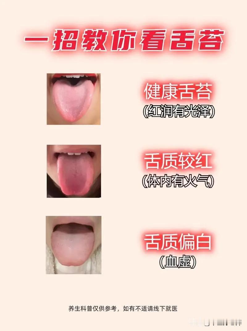 中医一招教你看会舌苔#健康##舌象#