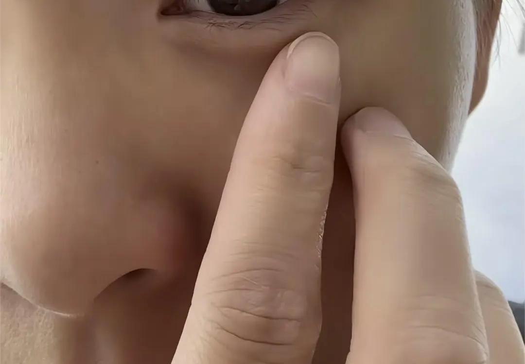 女生眼里飞进小虫，徒手一把扒拉出！医生：胆大的人，反而更吃亏

刷到一个很颠覆认