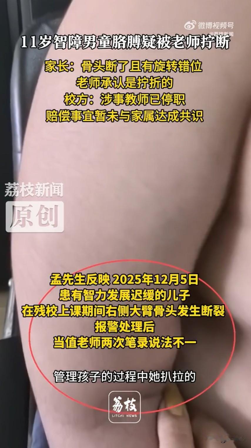 辽宁铁岭一起特殊教育学校的事件让无数网友揪心又愤怒，教师拧断11岁男童胳膊事发地