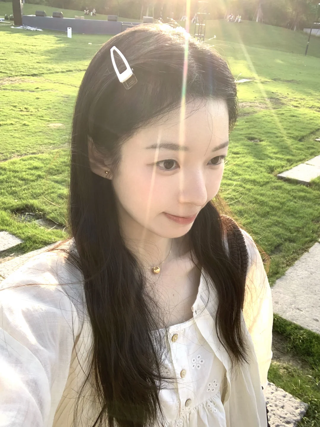 植发四个月啦～小绒毛长出来了