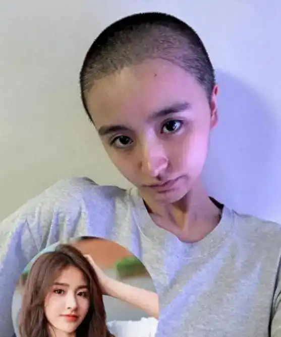 27岁女星金子涵再曝猛料：遭注射不明物质，三年闭经、耳道长霉菌听力受损， 8月晒