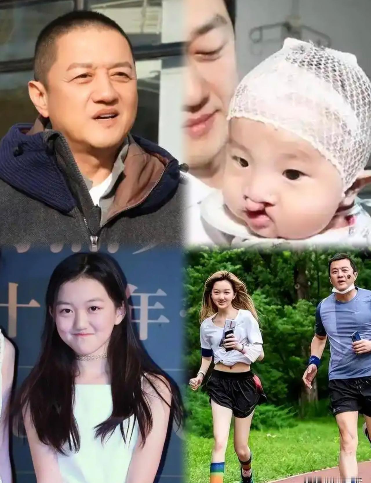 你见过一种裂痕吗？
它长在婴儿脸上，却撕开了上万家庭的绝望。
王菲和李亚鹏没时间