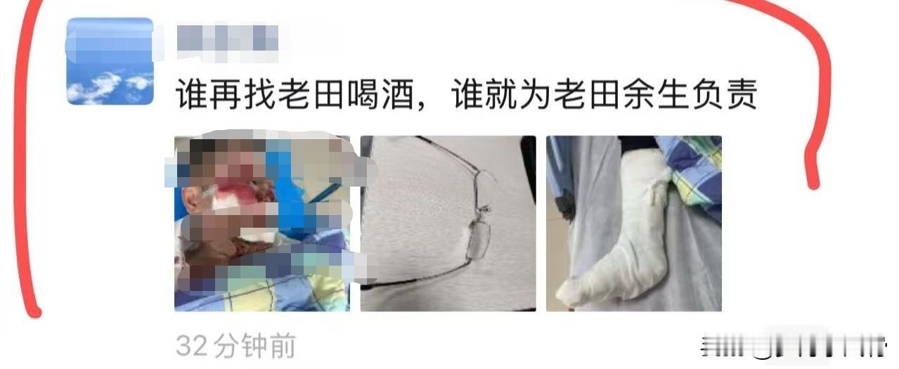 一位朋友的媳妇急了，谁再找老田喝酒，谁为老田余生负责，看来老公喝酒摔的不轻，酒这
