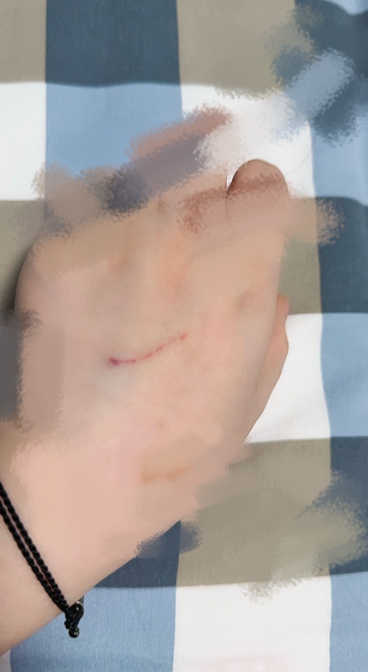 我什么时候能把自己哄好…（医生今天拔针是针头接触皮肤抽出来的……🥺 
