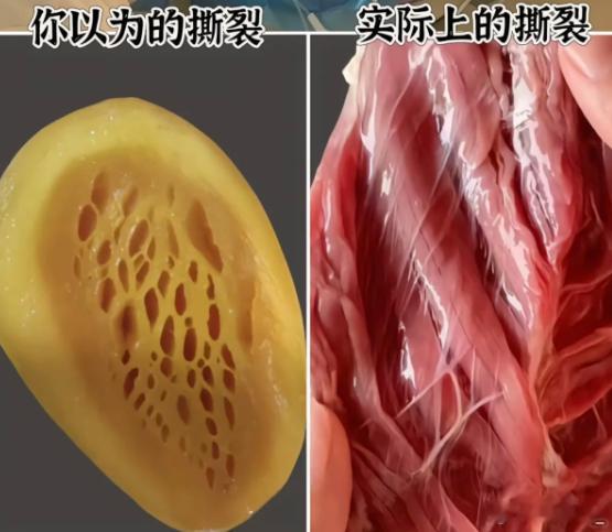 怀孕后脏器都被挤变形了 自我上次刷到“顺产撕裂”之后，我才知道生小孩有这么多生育