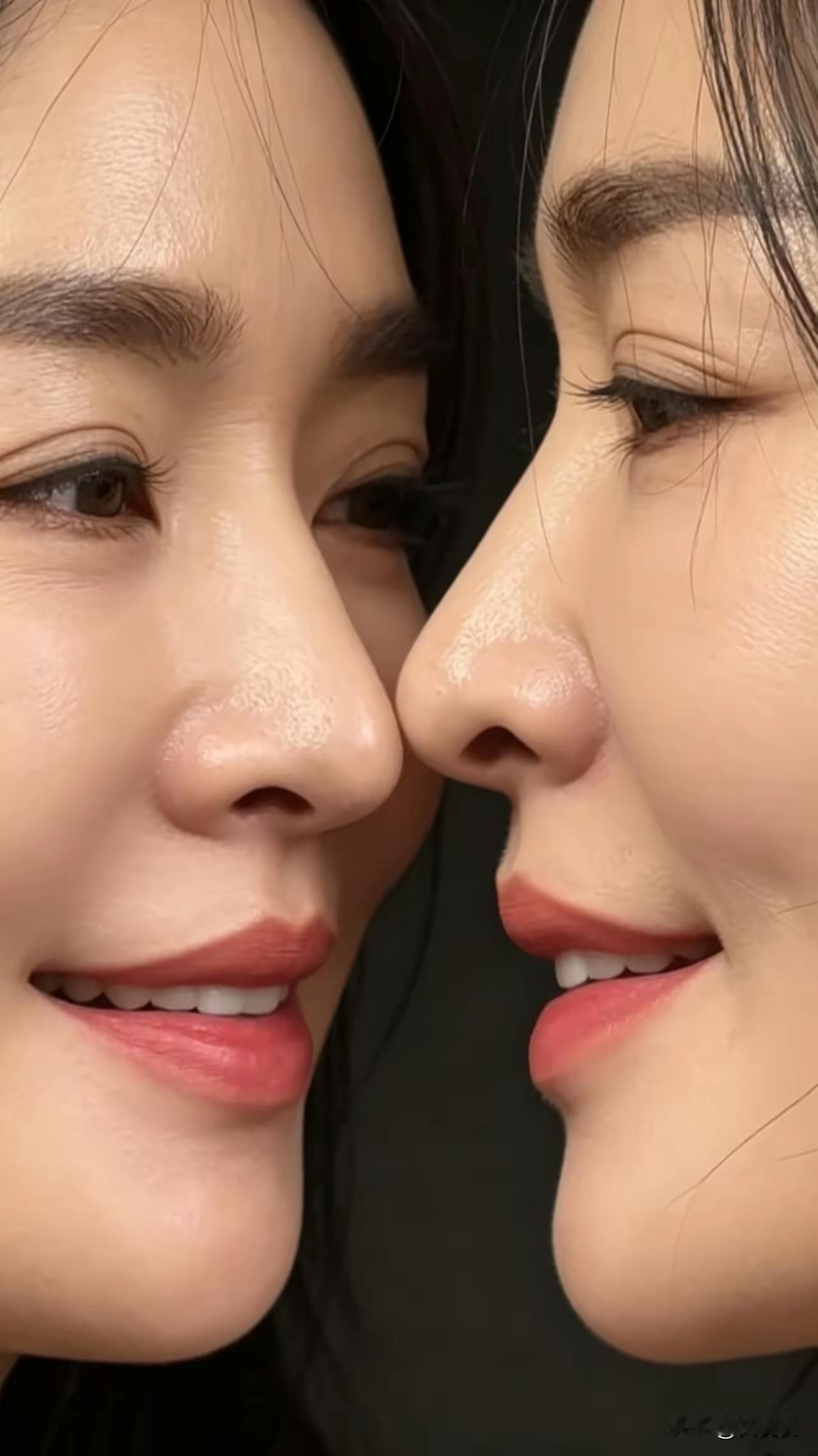 上眼皮全是皱纹，应该年龄不小。
如果我猜的不错的话
最少有五十了吧！[泪奔]