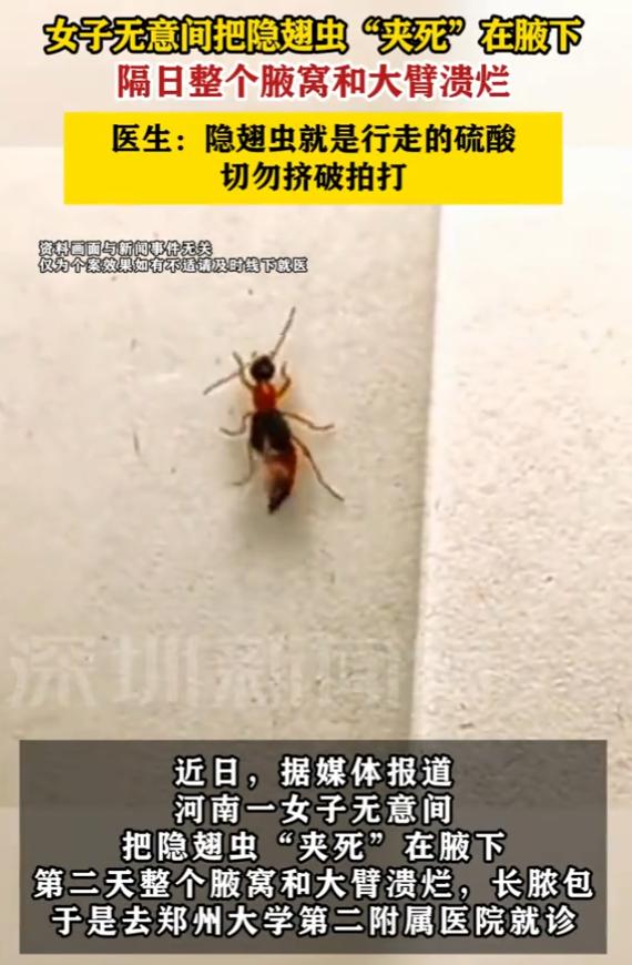 “悲剧还是发生了！”8月28日报道，河南郑州，一女子无意间，把隐翅虫“夹死”在腋