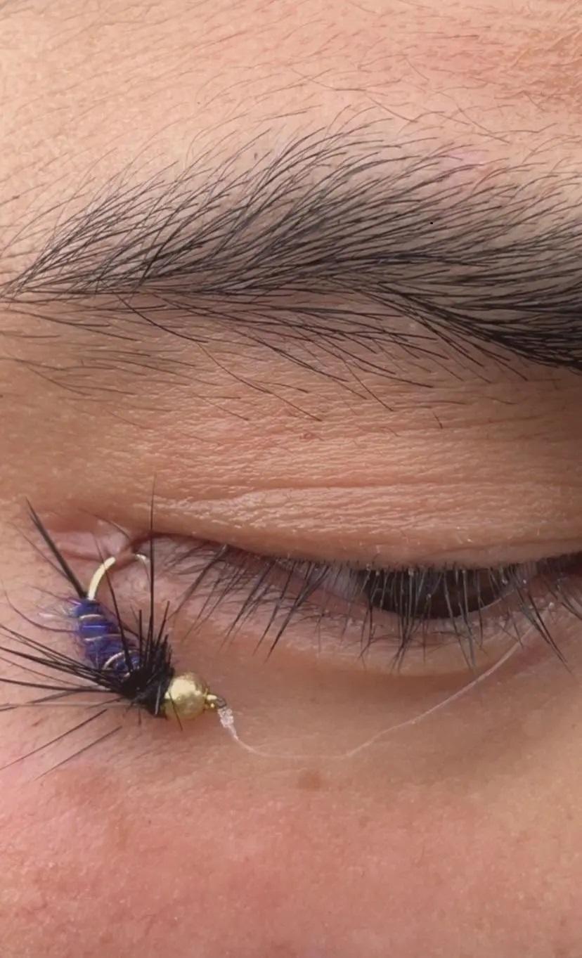 我以为假睫毛掉了，仔细一看不是这么简单[捂脸]