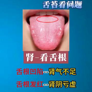 教你如何通过舌苔发现问题。
教你如何通过舌苔看问题。
·肾：看舌根。舌中有裂纹多