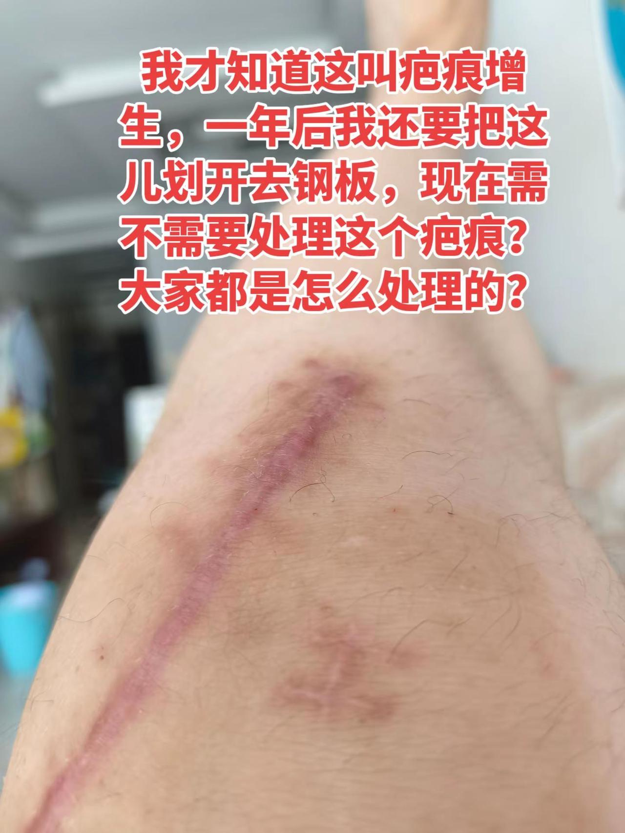 用什么药合适？广告勿扰！