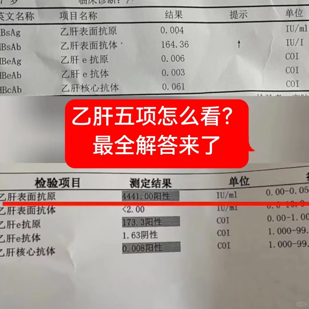 乙肝五项怎么看？最全解答来了 