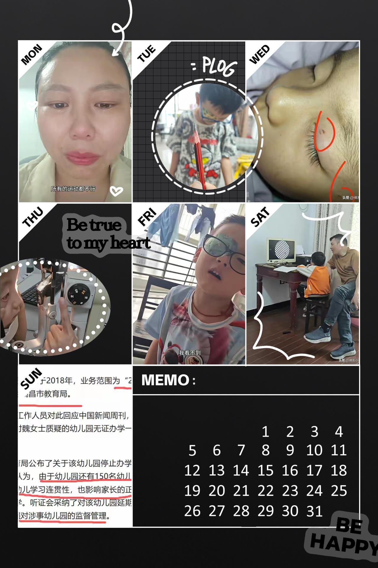 谁看了不心疼！江西5岁男童在幼儿园被铅笔戳伤左眼，老师不送医反而抹猪油，等家长发