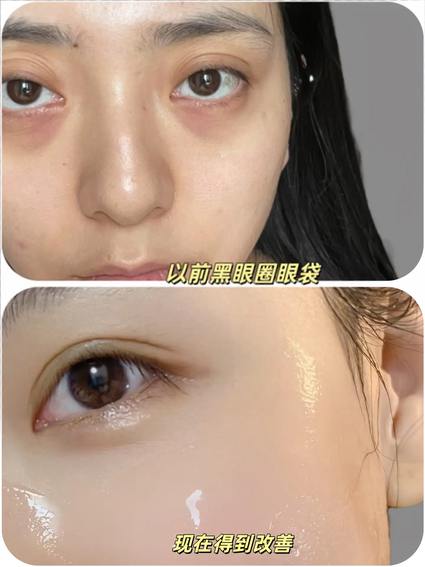 除黑眼圈眼袋用眼膜贴。姐妹们眼膜贴淡化黑眼圈眼袋，熬夜看手机看电脑就用它