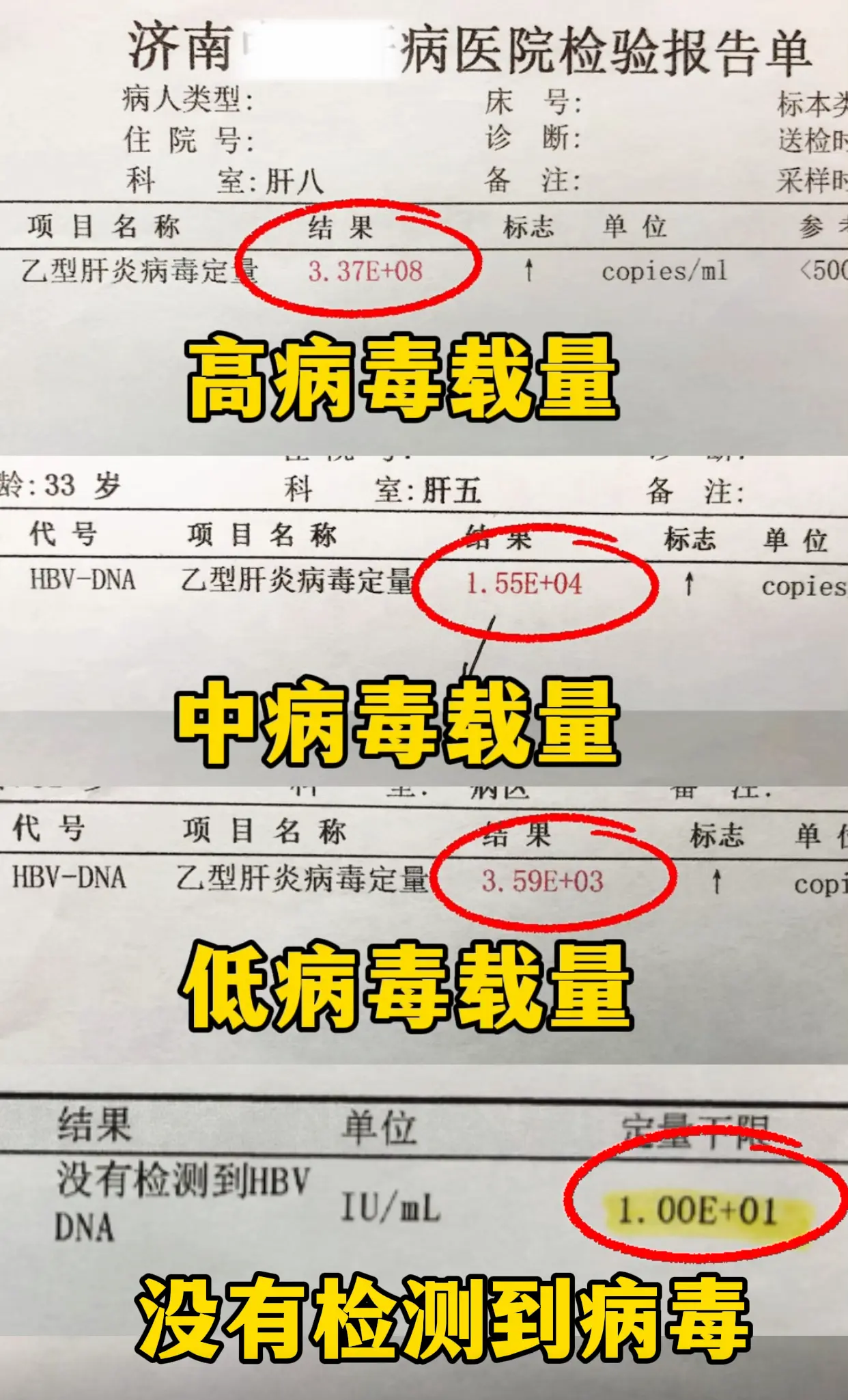 乙肝 病毒量 健康科普 大三阳 肝病教授陈士俊