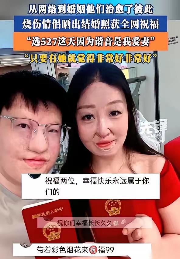 杭州有一对情侣，男方8个月大时被烫伤，女方6岁时被烧伤。两个人身上的疤，各自带了