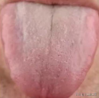 肝郁，为什么用柴胡疏肝无效？
患者主诉:胸闷气短，头晕发昏，容易心烦，而且脾气暴