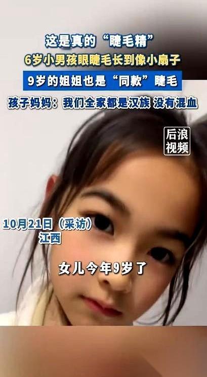 睫毛长到要用梳子梳，我第一次听说。
江西上饶一个6岁的小男孩，睫毛快2厘米了。真