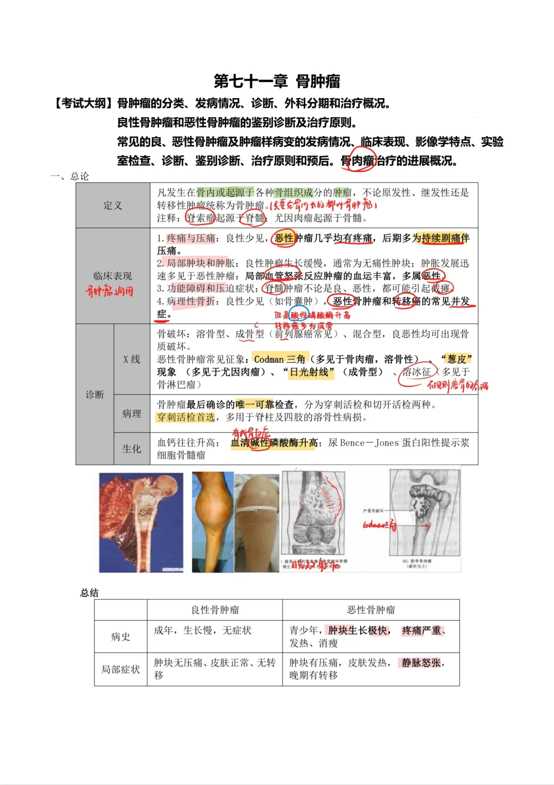 外科学-骨肿瘤