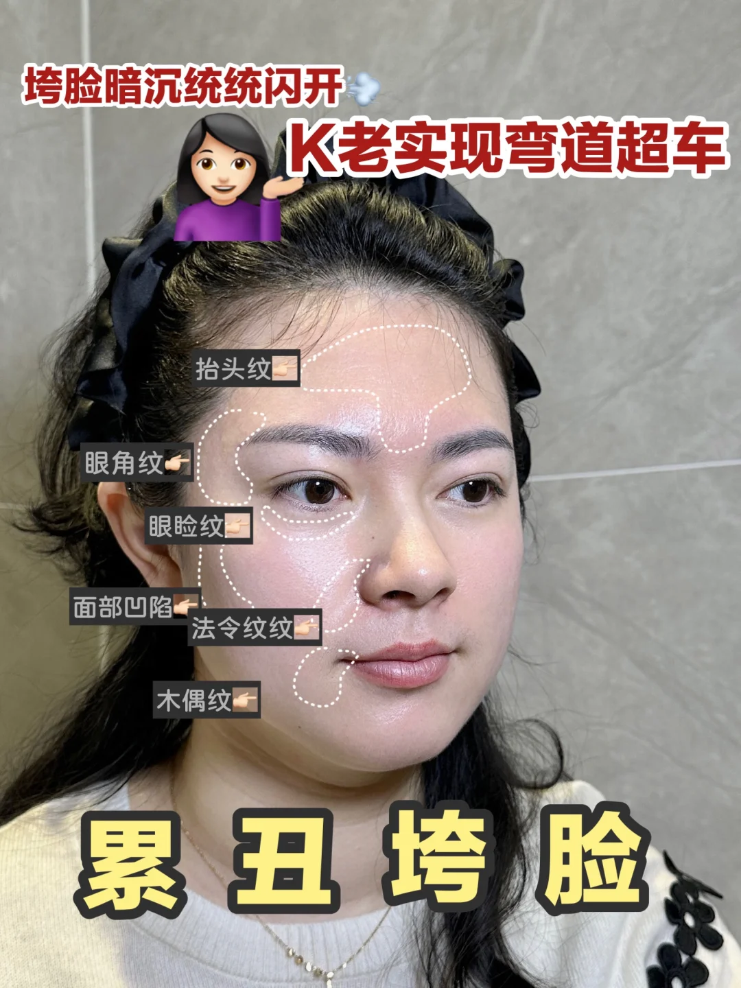 打赢岁月这把杀猪刀！脸蛋紧到发蒙