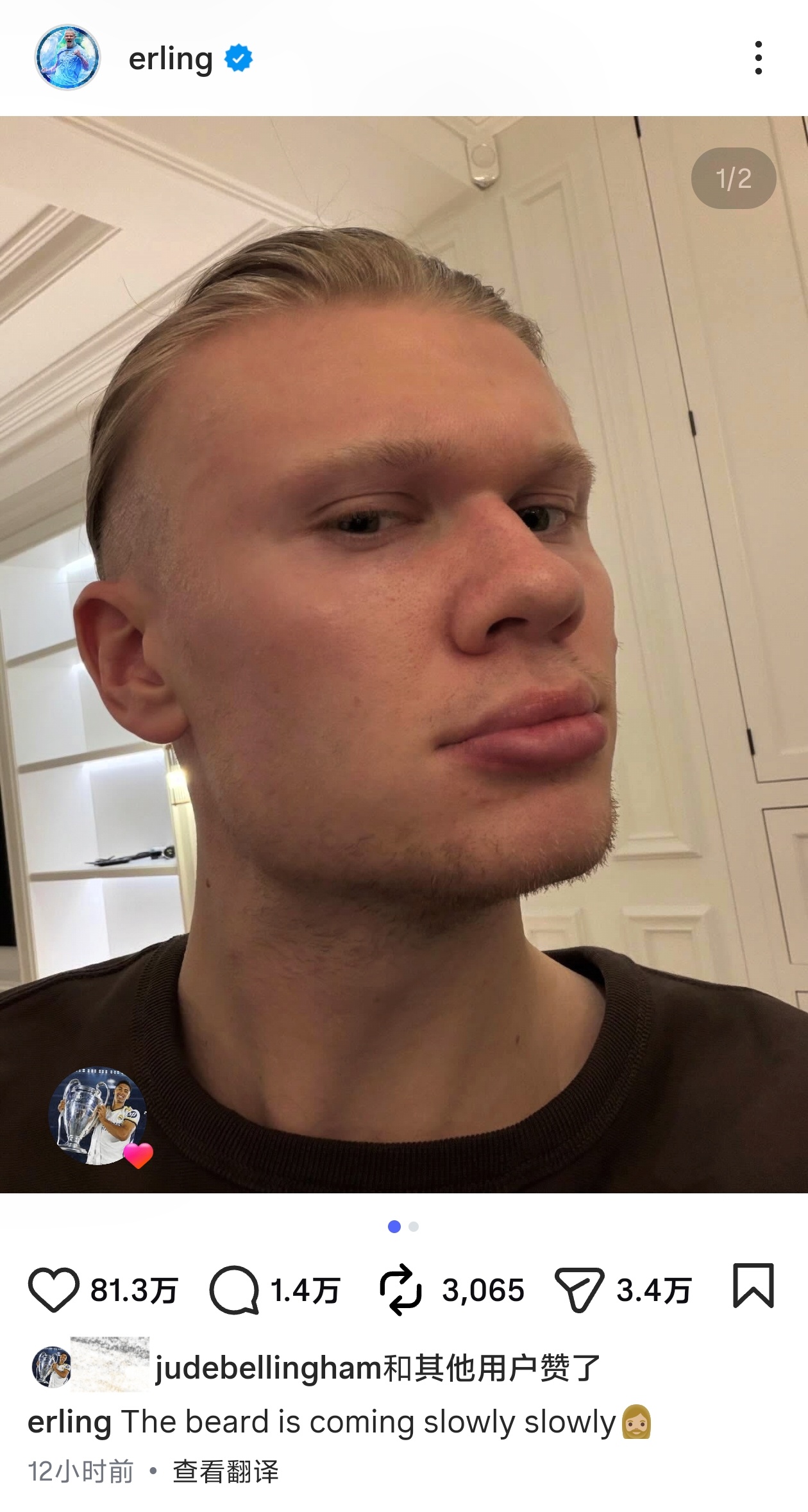 给哈兰德留胡子的动态点赞
