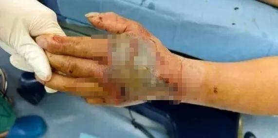 从小生活在农村，小时候，就有大人或大孩子告诫小孩子，看见蛇一定要远离。

说蛇这