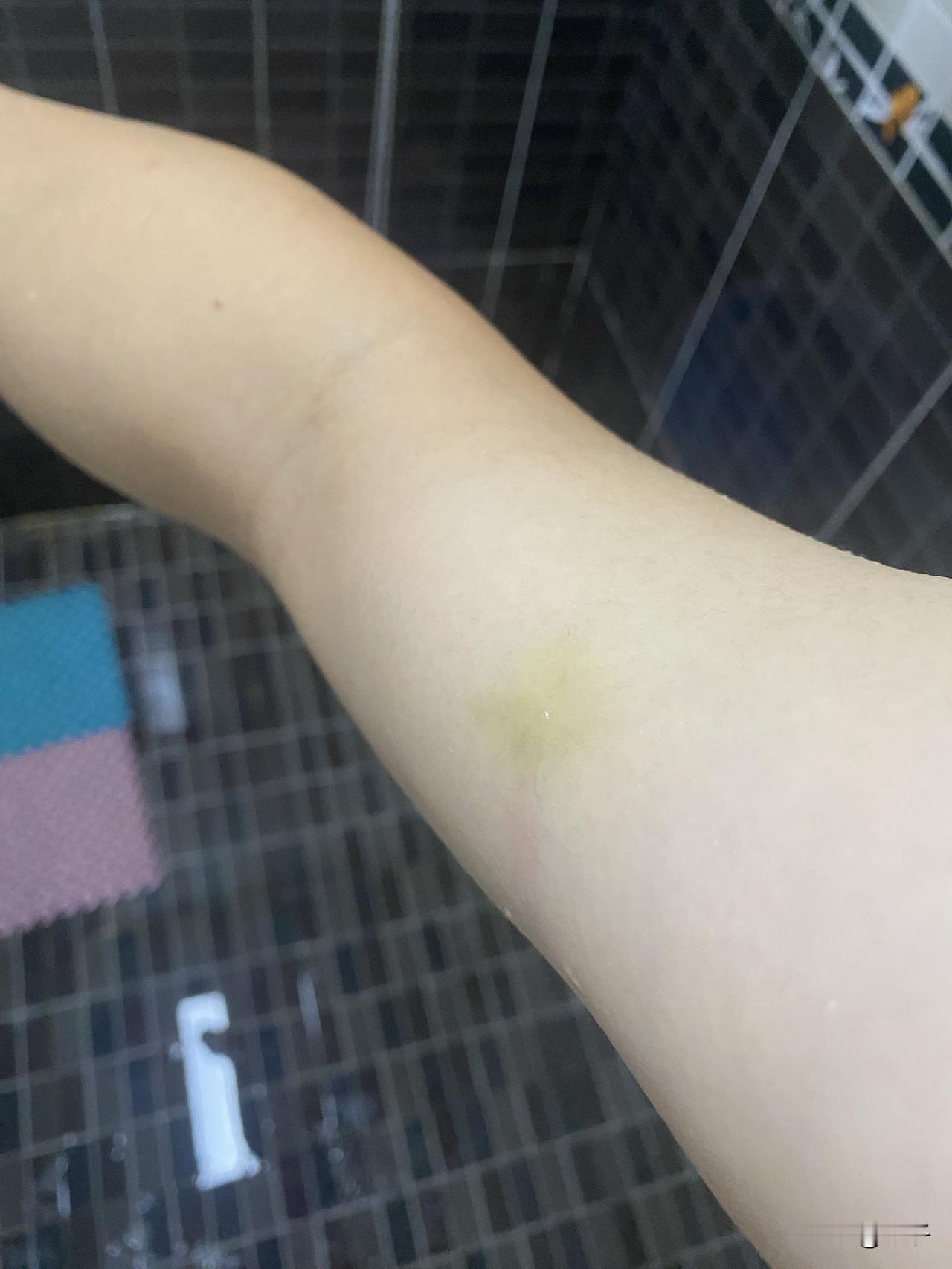 这辈子不知道能不能逃出这个婚姻的牢笼了，这都不知道是第几次动手了，想起曾经怀孕的