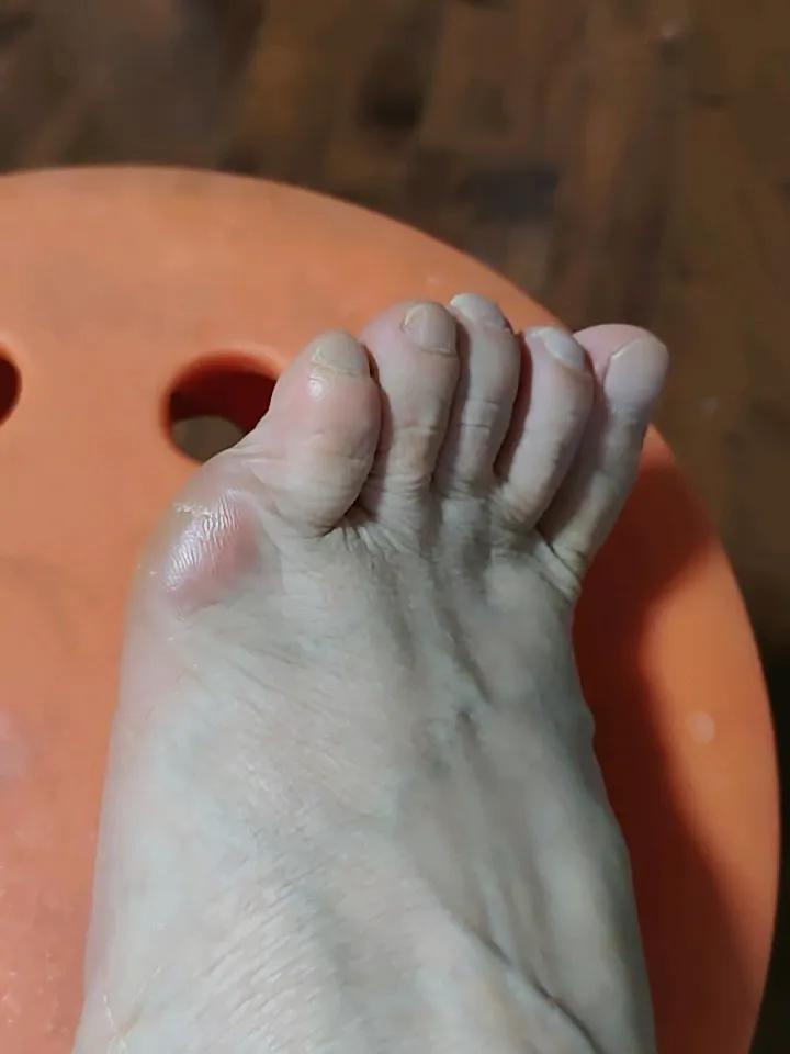 一直以来都嫌乎自己的手，做公交都不好意思抓扶手。看我的手，是不是感觉我骨瘦如柴，