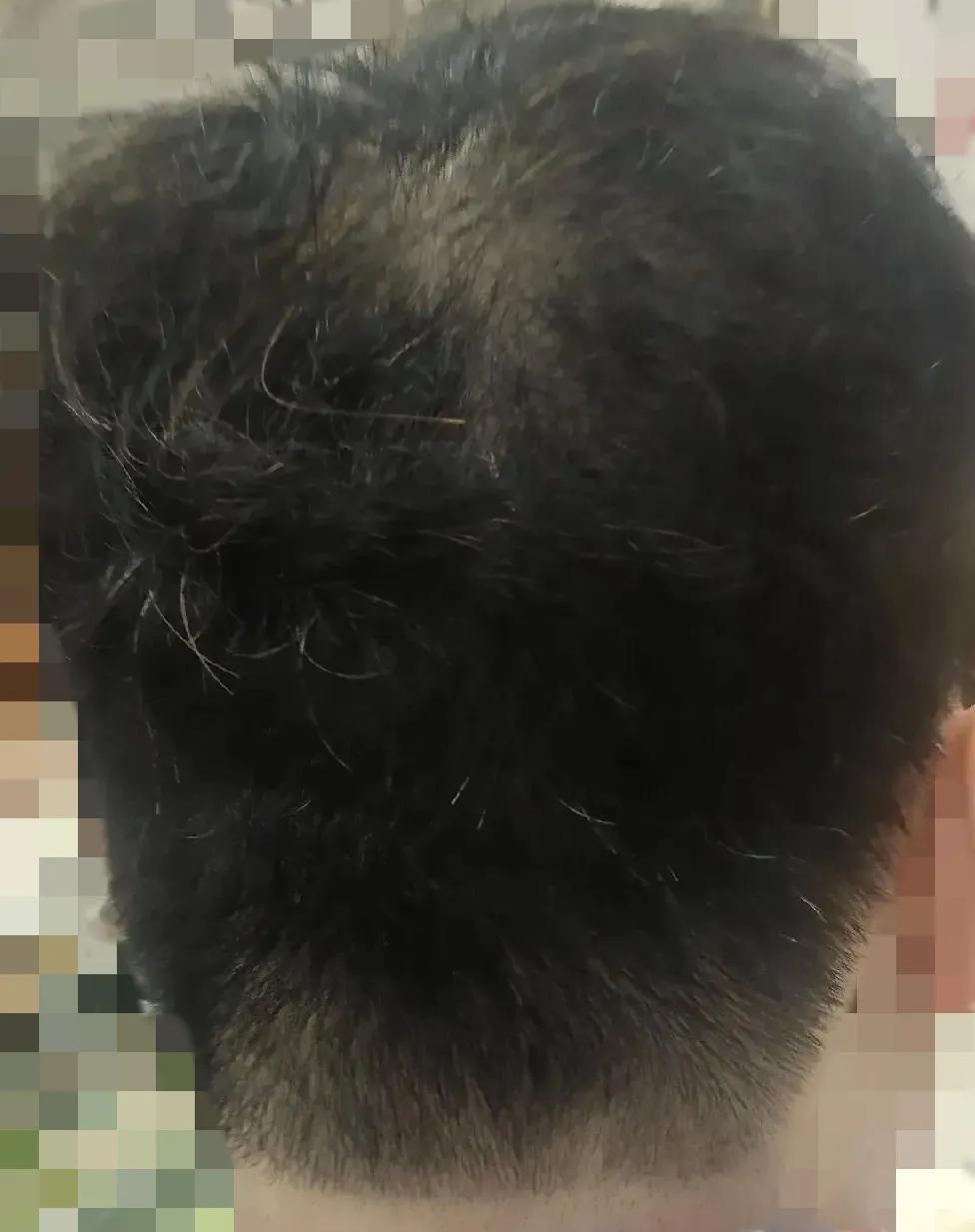 在此我要告诉所有爱美的女人们，如果你有白头发，染发一定要买贵的，买那种添加剂少的