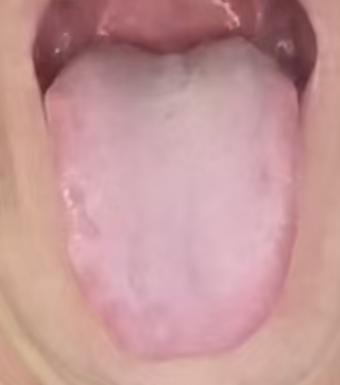 男性宗筋失养，中医调理的关键要点






有不少朋友遇到了宗筋不振不能行事的